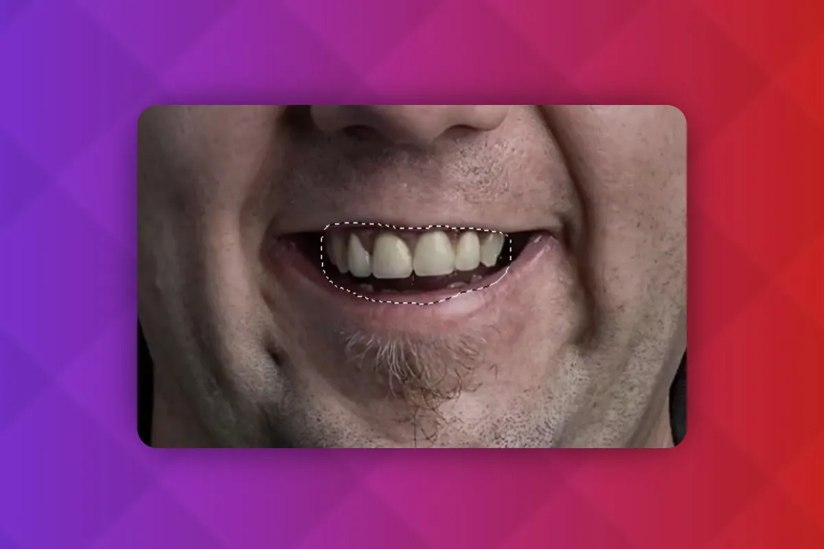 Photoshop-Techniken: 3.30 | Zähne weißer machen & Flecken entfernen