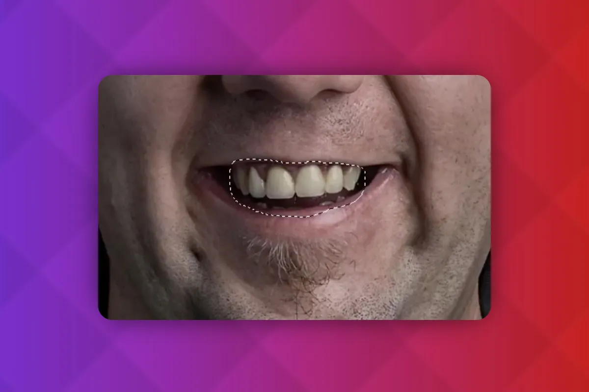 Tecniche di Photoshop: 3.30 | Sbiancare i denti e rimuovere le macchie