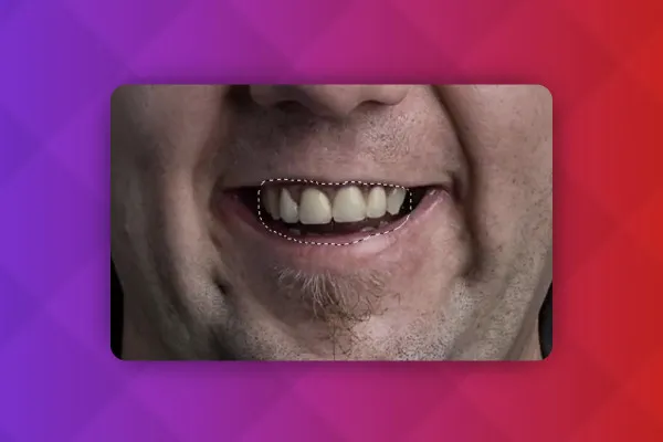 Tecniche di Photoshop: 3.30 | Sbiancare i denti e rimuovere le macchie
