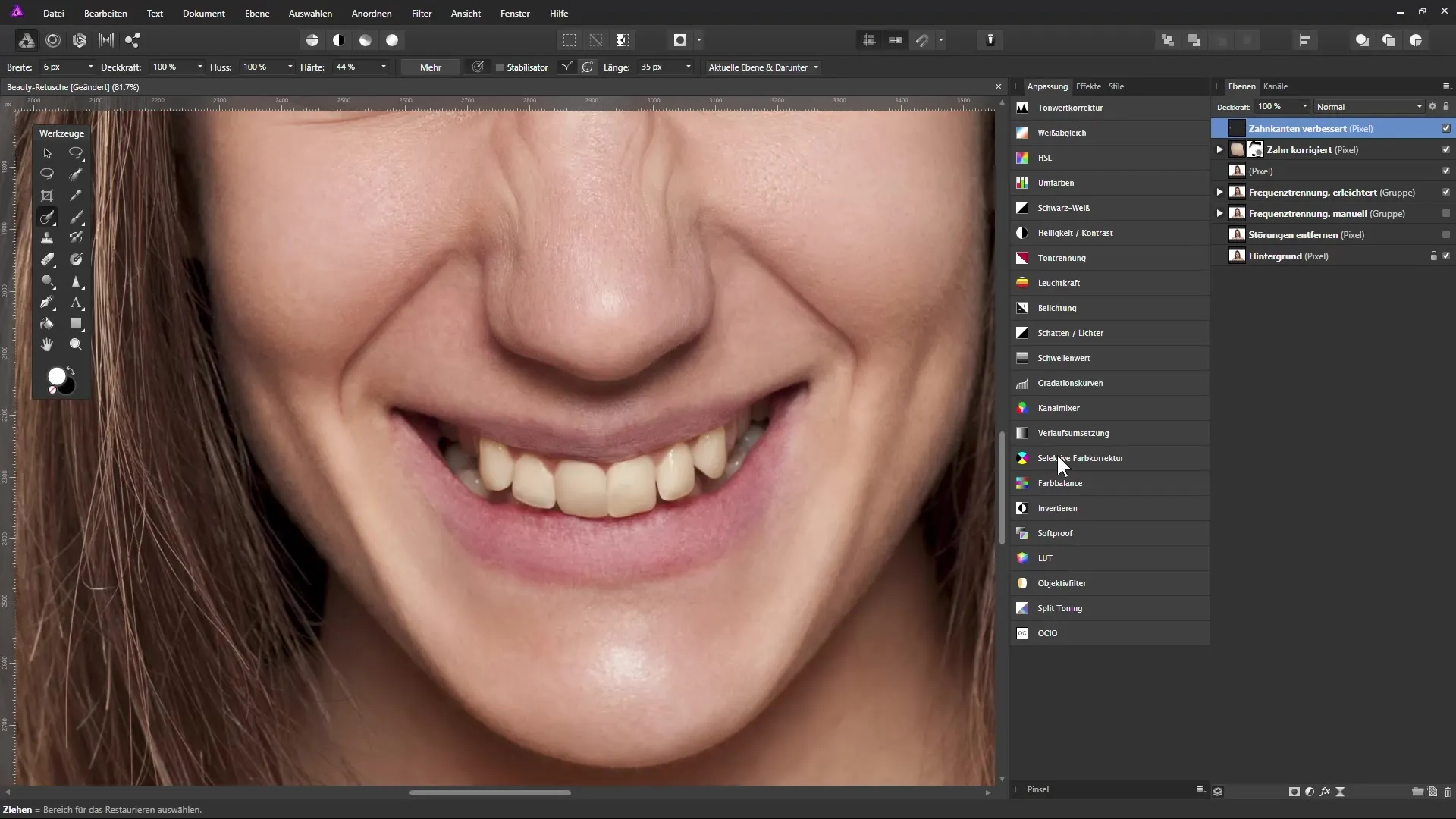 Zähne effektiv korrigieren und aufhellen in Affinity Photo