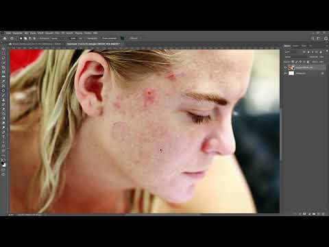 Photoshop teknikleri: 2.18 | Cilt kusurlarını ve sivilceleri temizleme